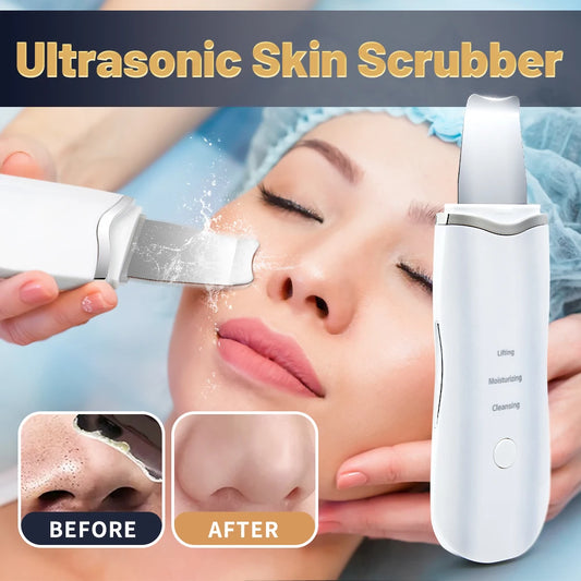 Limpiador ultrasónico de poros, exfoliante, eliminador de puntos negros, limpieza facial profunda, limpiador facial ultrasónico con pala iónica.