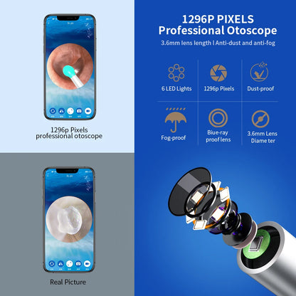 Limpiador de oídos NE3, herramienta de eliminación de cerumen de alta precisión con cámara y luz LED, otoscopio inalámbrico, kit de limpieza de oídos inteligente, el mejor regalo.