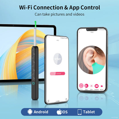 Limpiador de oídos con cámara, otoscopio inalámbrico con carga USB C, endoscopio, herramienta para eliminar cera, minicámara