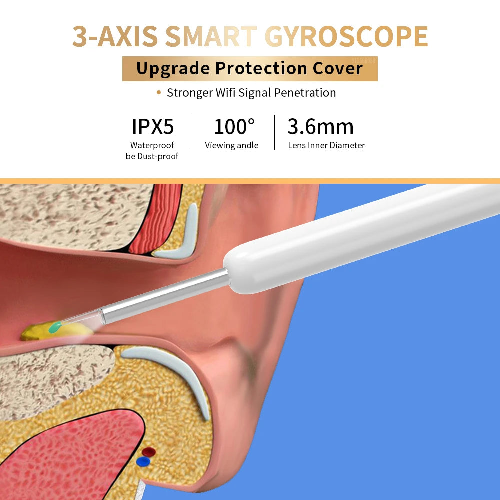 Limpiador de oídos NE3, herramienta de eliminación de cerumen de alta precisión con cámara y luz LED, otoscopio inalámbrico, kit de limpieza de oídos inteligente, el mejor regalo.